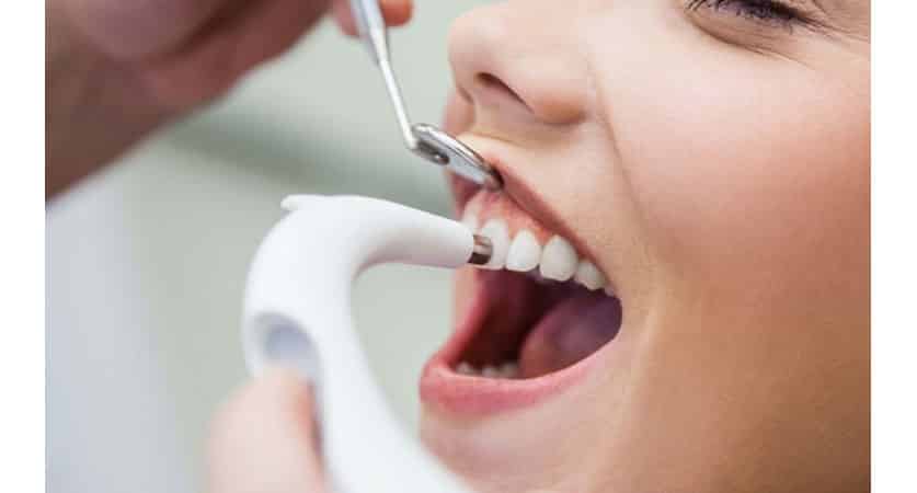 disadvantages of deep cleaning teeth